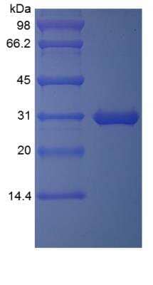 SDS-Page: Human TIGAR/C12orf5 TAT Protein [NBP2-35063]