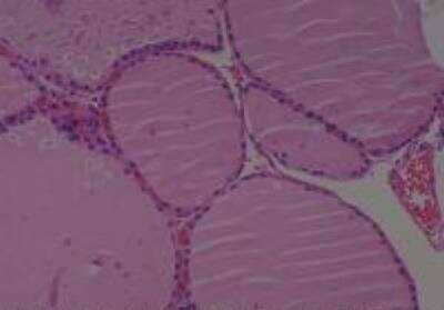 Hematoxylin & Eosin Stain: Human Thyroid Tissue MicroArray (Cancer) [NBP2-30317] -  54. Thyroid, benign thyroid tissue