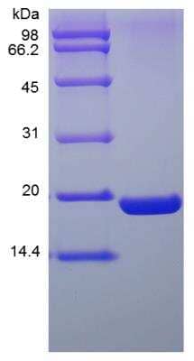 SDS-Page: Human UBE2I/Ubc9 His (N-Term) Protein [NBP2-35094]