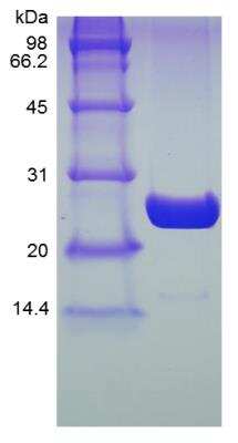 SDS-PAGE Recombinant Human UBE2K/E2-25K His (N-Term) Protein