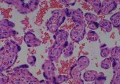 Hematoxylin & Eosin Stain: Human Various Tissue MicroArray (Cancer) [NBP2-30233] -  26. Placenta