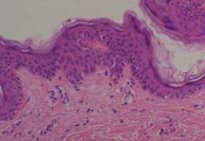 Hematoxylin & Eosin Stain: Human Various Tissue MicroArray (Cancer) [NBP2-30234] - 1. Skin Normal