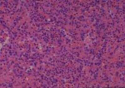 Hematoxylin & Eosin Stain: Human Various Tissue MicroArray (Cancer) [NBP2-30234] - 3. Spleen Normal