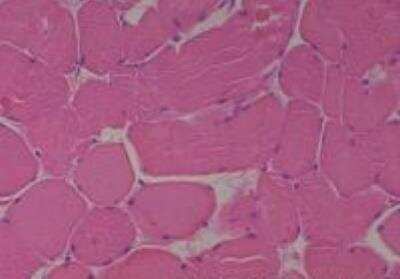 Hematoxylin & Eosin Stain: Human Various Tissue MicroArray (Cancer) [NBP2-30234] - 4. Skeletal Muscle