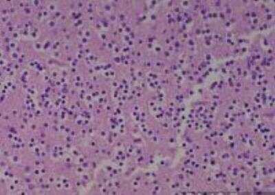 Hematoxylin & Eosin Stain: Human Various Tissue MicroArray (Cancer) [NBP2-30234] - 12. Brain Normal