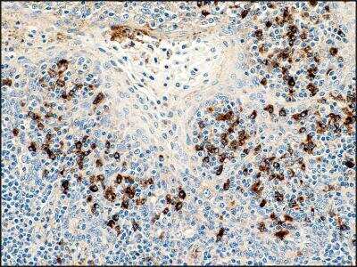 Immunohistochemistry-Paraffin: Human lambda light chain Antibody (K22-Y) [NBP2-21837] - Formalin-fixed and paraffin-embedded human tonsil tissue (4 um) stained with anti-Human Lambda Light Chain antibody.