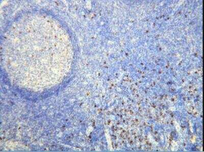 Immunohistochemistry-Paraffin: Human lambda light chain Antibody (K22-Y) [NBP2-21837] - Expression of the Lambda Light Chain immunoglobulin in the plasma cells of the palatine tonsil. Formalin fixed, paraffin embedded human tissues (4 um sections) stained with anti-Human Lambda light chain monospecific clonal antibody.