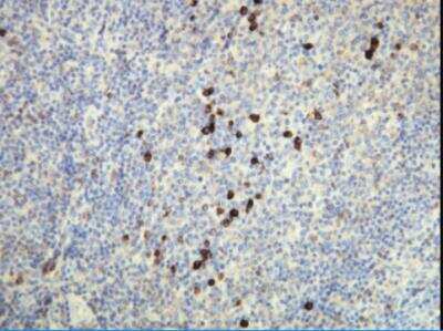 Immunohistochemistry-Paraffin: Human lambda light chain Antibody (K22-Y) [NBP2-21837] - Expression of the Lambda Light Chain immunoglobulin in the plasma cells of the palatine tonsil. Formalin fixed, paraffin embedded human tissues (4 um sections) stained with anti-Human Lambda light chain monospecific clonal antibody.