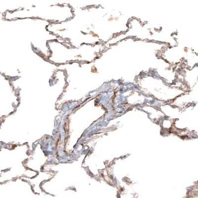 Immunohistochemistry-Paraffin: Hyaluronan Synthase 3/HAS3 Antibody [NBP1-86328] - Staining of human lung shows moderate positivity in respiratory epithelial cells.