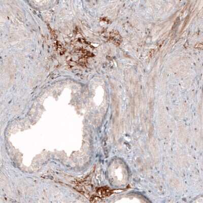 Immunohistochemistry-Paraffin: Hyaluronan Synthase 3/HAS3 Antibody [NBP1-86328] - Staining of human prostate shows moderate to strong positivity in the extracellular matrix.