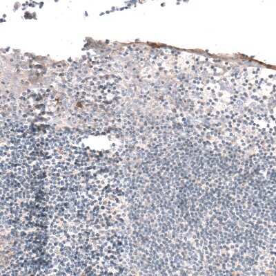 Immunohistochemistry-Paraffin: Hyaluronan Synthase 3/HAS3 Antibody [NBP1-86328] - Staining of human tonsil shows no positivity in lymphoid cells as expected.