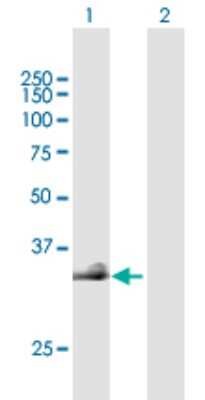 Western Blot: Hyaluronan Synthase 3/HAS3 Antibody [H00003038-B02P] - Analysis of HAS3 expression in transfected 293T cell line by HAS3 polyclonal antibody.  Lane 1: HAS3 transfected lysate(31.02 KDa). Lane 2: Non-transfected lysate.
