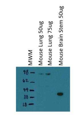Western Blot: Hyaluronan Synthase 3/HAS3 Antibody [NBP1-86328] - Lane 1: 50ug  mouse whole lung lysate. Lane 2: 75ug mouse whole lung lysate. Lane 3: 50ug mouse brainstem lysate. Antibody at 1:1000. Image submitted by a verified customer review.