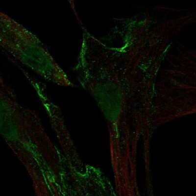Immunocytochemistry/Immunofluorescence: Hyaluronan synthase 1 Antibody [NBP2-39087] - Staining of human cell line LHCN-M2 shows localization to nucleoplasm & plasma membrane. Antibody staining is shown in green.