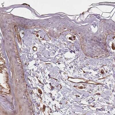 Immunohistochemistry-Paraffin: Hyaluronan synthase 1 Antibody [NBP2-39087] - Staining of human skin shows moderate positivity in basement membrane of epithelial cells.