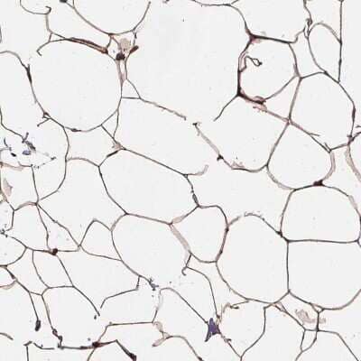 Immunohistochemistry-Paraffin: Hyaluronan synthase 1 Antibody [NBP2-39087] - Staining of human breast shows moderate membranous positivity in adipocytes.