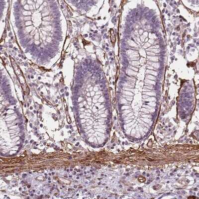 Immunohistochemistry-Paraffin: Hyaluronan synthase 1 Antibody [NBP2-39087] - Staining of human colon shows moderate membranous positivity in smooth muscle cells.