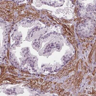 Immunohistochemistry-Paraffin: Hyaluronan synthase 1 Antibody [NBP2-39087] - Staining of human prostate shows strong membranous positivity in smooth muscle cells.