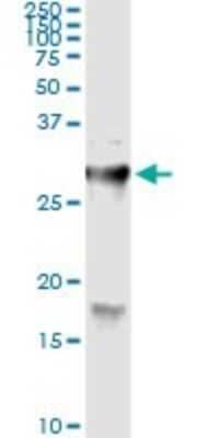 Immunoprecipitation: Hyaluronidase 1/HYAL1 Antibody (2H7) [H00003373-M01] - Analysis of HYAL1 transfected lysate using anti-HYAL1 monoclonal antibody and Protein A Magnetic Bead, and immunoblotted with HYAL1 MaxPab rabbit polyclonal antibody.