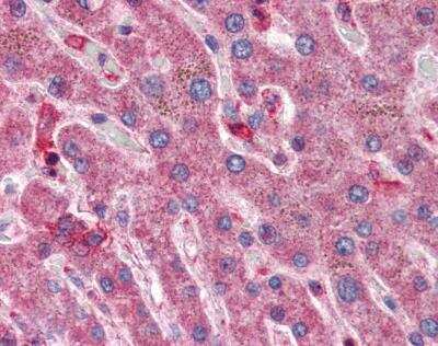 Immunohistochemistry Hyaluronidase 1/HYAL1 Antibody