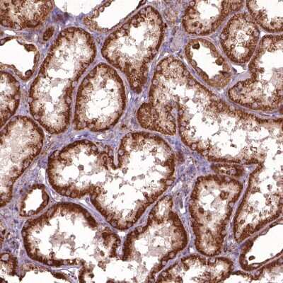 Immunohistochemistry-Paraffin: Hyaluronidase 1/HYAL1 Antibody [NBP1-83409] - Staining of human kidney shows moderate to strong granular cytoplasmic positivity in cells in tubules.