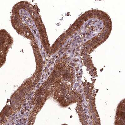 Immunohistochemistry-Paraffin: Hyaluronidase 1/HYAL1 Antibody [NBP1-83409] - Staining of human gallbladder shows moderate to strong granular cytoplasmic positivity in glandular cells.