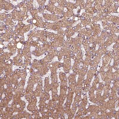 Immunohistochemistry-Paraffin Hyaluronidase 1/HYAL1 Antibody - BSA Free