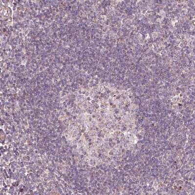 Immunohistochemistry-Paraffin: Hyaluronidase 1/HYAL1 Antibody [NBP1-83409] - Staining of human tonsil shows very weak positivity as expected.
