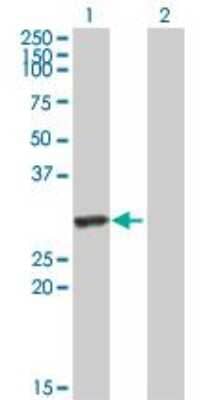 Western Blot: Hyaluronidase 1/HYAL1 Antibody [H00003373-B01P] - analysis of HYAL1 expression in transfected 293T cell line by HYAL1 purified MaxPab polyclonal antibody (B01P). Lane 1: HYAL1 transfected lysate (28.00 KDa). Lane 2: Non-transfected lysate.