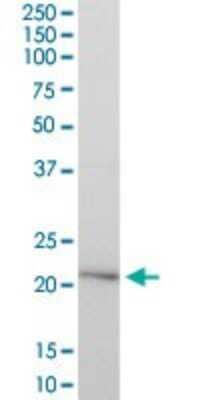 Western Blot: Hyaluronidase 1/HYAL1 Antibody [H00003373-B01P] - Analysis of HYAL1 expression in human kidney.