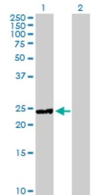 Western Blot: Hyaluronidase 1/HYAL1 Antibody [H00003373-D01P] - Analysis of HYAL1 expression in transfected 293T cell line by HYAL1 polyclonal antibody.Lane 1: HYAL1 transfected lysate(28.00 KDa).Lane 2: Non-transfected lysate.