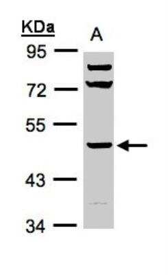 Western Blot: Hyaluronidase 1/HYAL1 Antibody [NBP1-32465] - Sample(30 ug whole cell lysate)A:293T7. 5% SDS PAGE, antibody diluted at 1:1000.