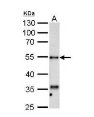 Western Blot Hyaluronidase 1/HYAL1 Antibody - BSA Free