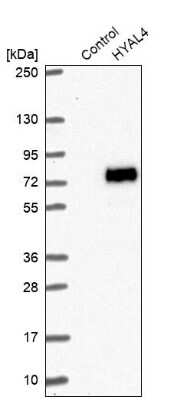 Western Blot Hyaluronidase 4/HYAL4 Antibody