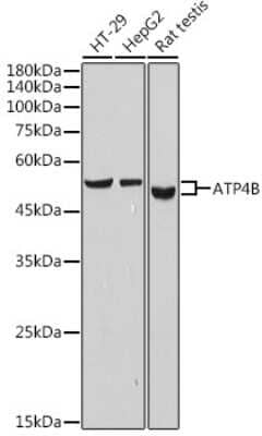 Western Blot: Hydrogen Potassium ATPase Beta Antibody (3Y1Y1) [NBP3-15739] - Western blot analysis of extracts of various cell lines, using Hydrogen Potassium ATPase Beta antibody (NBP3-15739) at 1:1000 dilution. Secondary antibody: HRP Goat Anti-Rabbit IgG (H+L) at 1:10000 dilution. Lysates/proteins: 25ug per lane. Blocking buffer: 3% nonfat dry milk in TBST. Detection: ECL Basic Kit. Exposure time: 1s.