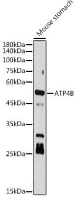 Western Blot: Hydrogen Potassium ATPase Beta Antibody (3Y1Y1) [NBP3-15739] - Western blot analysis of extracts of Mouse stomach, using Hydrogen Potassium ATPase Beta antibody (NBP3-15739) at 1:1000 dilution. Secondary antibody: HRP Goat Anti-Rabbit IgG (H+L) at 1:10000 dilution. Lysates/proteins: 25ug per lane. Blocking buffer: 3% nonfat dry milk in TBST. Detection: ECL Basic Kit. Exposure time: 180s.