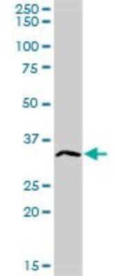 Western Blot: Hydrogen Potassium ATPase Beta Antibody [H00000496-D01P] - Analysis of ATP4B expression in human pancreas.