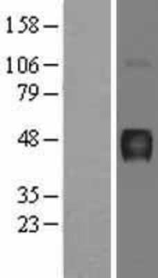 Western Blot: Hydrogen Potassium ATPase Beta Overexpression Lysate (Adult Normal) [NBL1-07815] Left-Empty vector transfected control cell lysate (HEK293 cell lysate); Right -Over-expression Lysate for Hydrogen Potassium ATPase Beta.