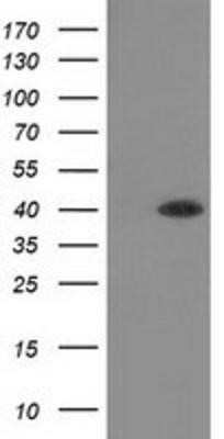 Western Blot: Hydroxyacid Oxidase-1/HAO-1 Antibody (OTI5C3) - Azide and BSA Free [NBP2-71954] - HEK293T cells were transfected with the pCMV6-ENTRY control (Left lane) or pCMV6-ENTRY HAO1 (Right lane) cDNA for 48 hrs and lysed. Equivalent amounts of cell lysates (5 ug per lane) were separated by SDS-PAGE and immunoblotted with anti-HAO1.