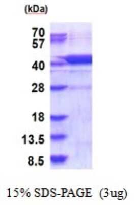 SDS-Page: Hydroxylysine kinase Recombinant Protein [NBP2-51865] - 15% SDS Page (3 ug)