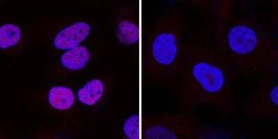 Knockout Validated: Hypoxic Post-Translational Modification Antibody Pack [NBP1-78948] - HIF-1 alpha was detected in immersion fixed DFO treated Hela cells (left) but was not detected in HIF-1 knockout HeLa cells (right) using Mouse Anti-human HIF-1 alpha monoclonal antibody (Catalog #NB100-105) at 25 ug/mL for 3 hours at room temperature. Cells were stained using a NorthernLights (TM) 557-conjugated Donkey Anti-Mouse IgG Secondary Antibody (red; Catalog # NL007) and counterstained with DAPI (blue). Specific staining was localized to nuclei. 