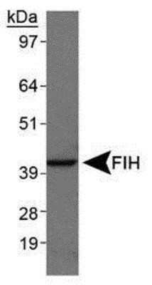 Western Blot: Hypoxic Post-Translational Modification Antibody Pack [NBP1-78948] - Western blot analysis of Factor Inhibiting HIF-1 Antibody in A431 cell lysates using NBP1-30333.