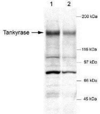 Western Blot: Hypoxic Post-Translational Modification Antibody Pack [NBP1-78948] - 3vials- Detection of tankyrase in DU145 whole cell lysates (50 ug) using NB 100-186. ECL detection - 30 seconds. Lane 1 - 1:500 primary dilution; Lane 2 - 1:2,000 primary dilution. Tankyrase 1 Antibody [NB100-186]