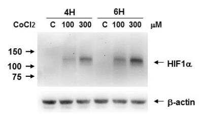 Western Blot: Hypoxic Post-Translational Modification Antibody Pack [NBP1-78948] - HIF-1 alpha induction by CoCl2 on Caki-1 cell lysate. Image from verified customer review. HIF-1 alpha Antibody (H1alpha67) [NB100-105]