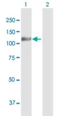 Western Blot: IA-2/PTPRN Antibody [H00005798-B02P] - Analysis of PTPRN expression in transfected 293T cell line by PTPRN polyclonal antibody.  Lane 1: PTPRN transfected lysate(104.5 KDa). Lane 2: Non-transfected lysate.