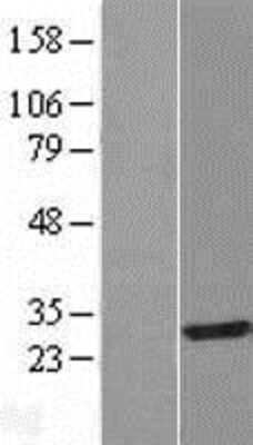Western Blot: IAH1 Overexpression Lysate (Adult Normal) [NBL1-11799] Left-Empty vector transfected control cell lysate (HEK293 cell lysate); Right -Over-expression Lysate for IAH1.
