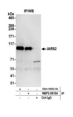 Immunoprecipitation: IARS2 Antibody [NBP2-59104] - Detection of human IARS2 by western blot of immunoprecipitates. Samples: Whole cell lysate (0.5 or 1.0 mg per IP reaction; 20% of IP loaded) from 293T cells prepared using NETN lysis buffer. Antibodies: Affinity purified rabbit anti-IARS2 antibody NBP2-59104 used for IP at 20 ul per reaction. IARS2 was also immunoprecipitated by another rabbit anti-IARS2 antibody. For blotting immunoprecipitated IARS2, NBP2-59104 was used at 1:100. Detection: Chemiluminescence with an exposure time of 30 seconds.