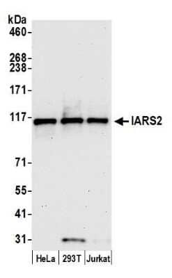 Western Blot: IARS2 Antibody [NBP2-59104] - Detection of human IARS2 by western blot. Samples: Whole cell lysate (15 ug) from HeLa, 293T, and Jurkat cells prepared using NETN lysis buffer. Antibody: Affinity purified rabbit anti-IARS2 antibody NBP2-59104 used for WB at 1:1000. Detection: Chemiluminescence with an exposure time of 30 seconds.