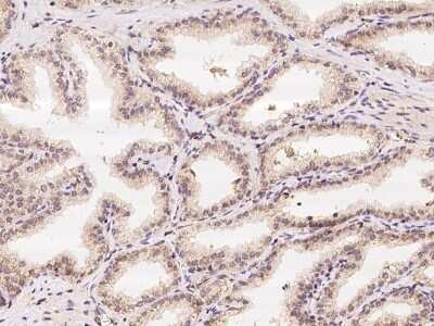 Immunohistochemistry-Paraffin: IBA57 Antibody [NBP2-98047] - Immunochemical staining of human IBA57 in human kidney with rabbit polyclonal antibody at 1:100 dilution, formalin-fixed paraffin embedded sections.
