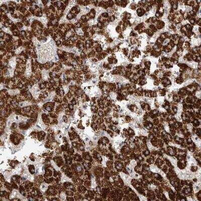 Immunohistochemistry: IBRDC1 Antibody [NBP1-88253] - Staining of human liver shows strong cytoplasmic positivity in hepatocytes.